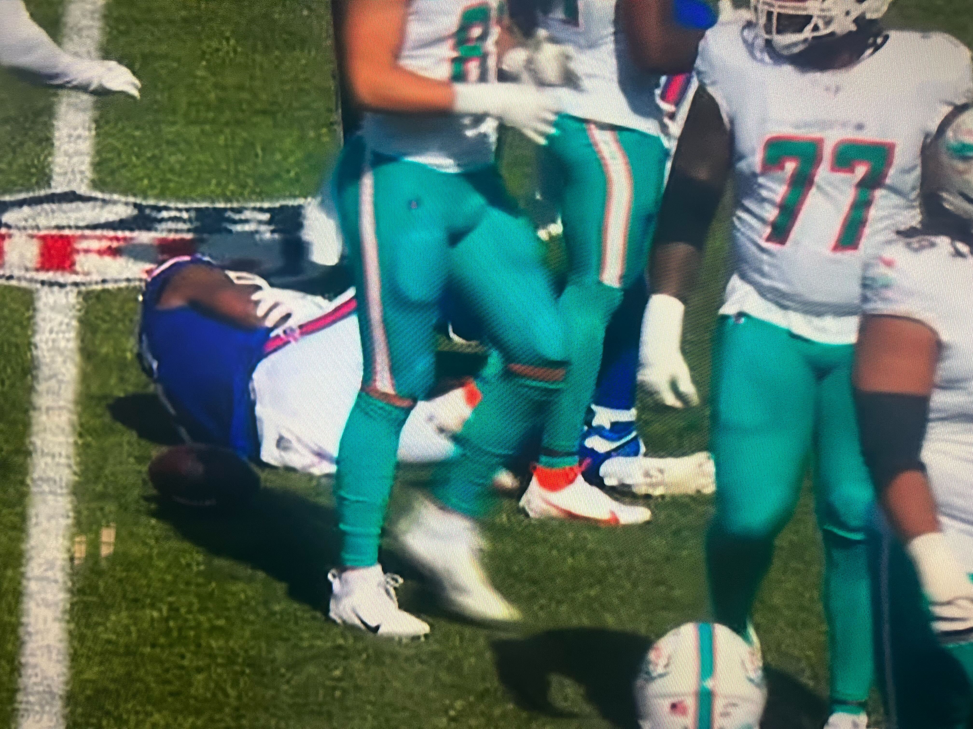 Buffalo Bills CB Christian Benford suffered an injury against the Miami Dolphins