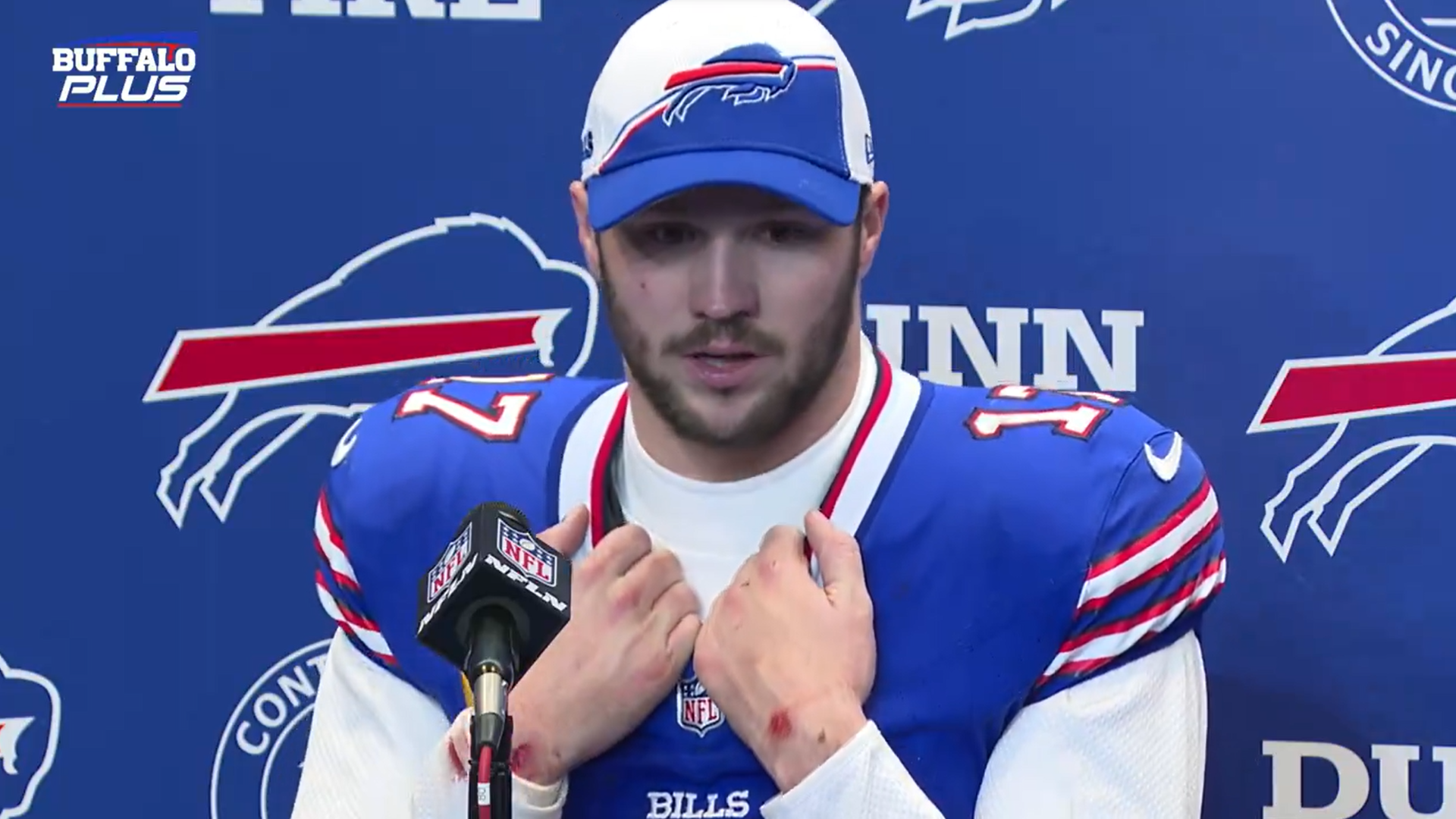 Buffalo Bills QB Josh Allen talks to the media after latest playoff loss to the Kansas City Chiefs.