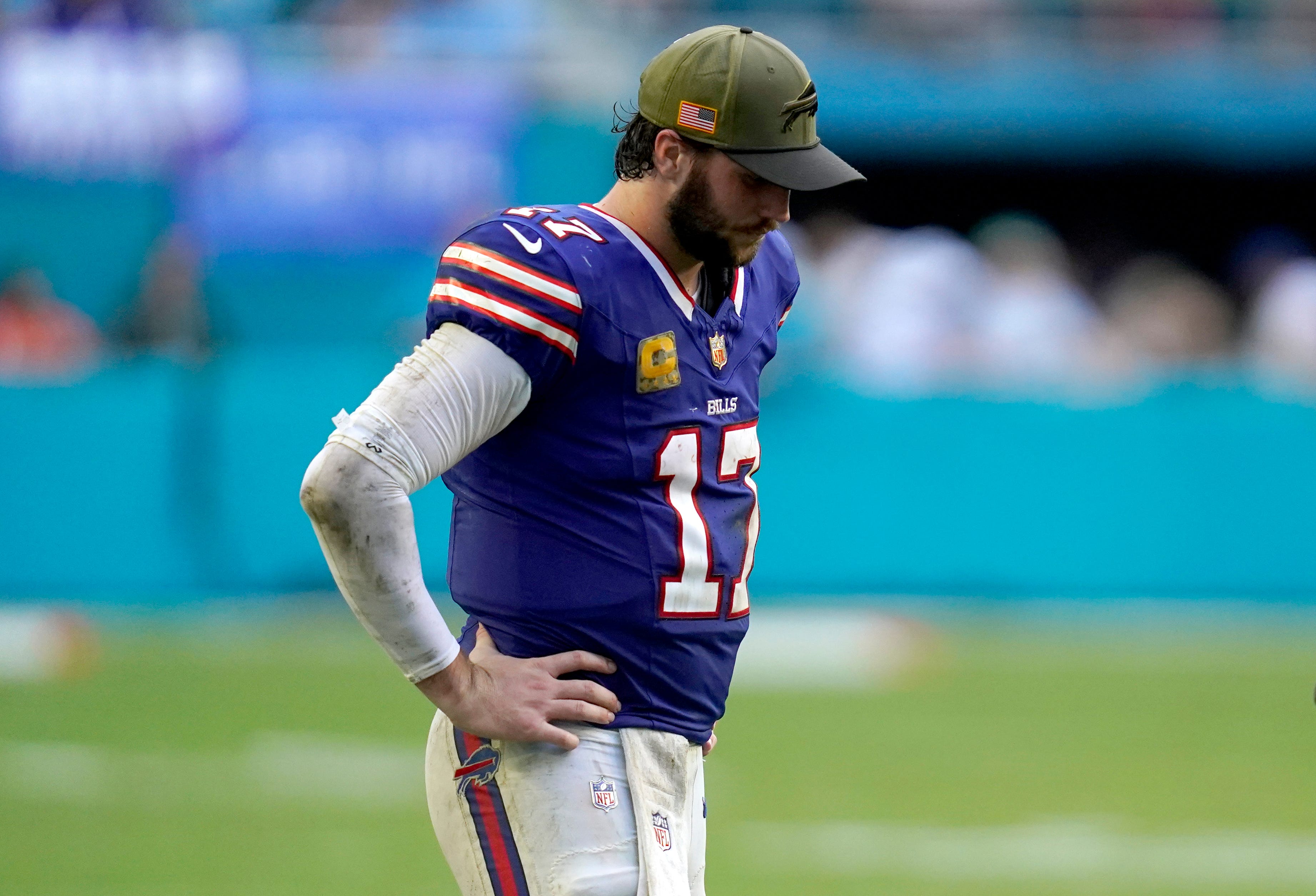 Nov 9, 2025; Miami Gardens, Florida, USA; Buffalo Bills quarterback Josh Allen (17) reacts during the second half against the Miami Dolphins at Hard Rock Stadium.